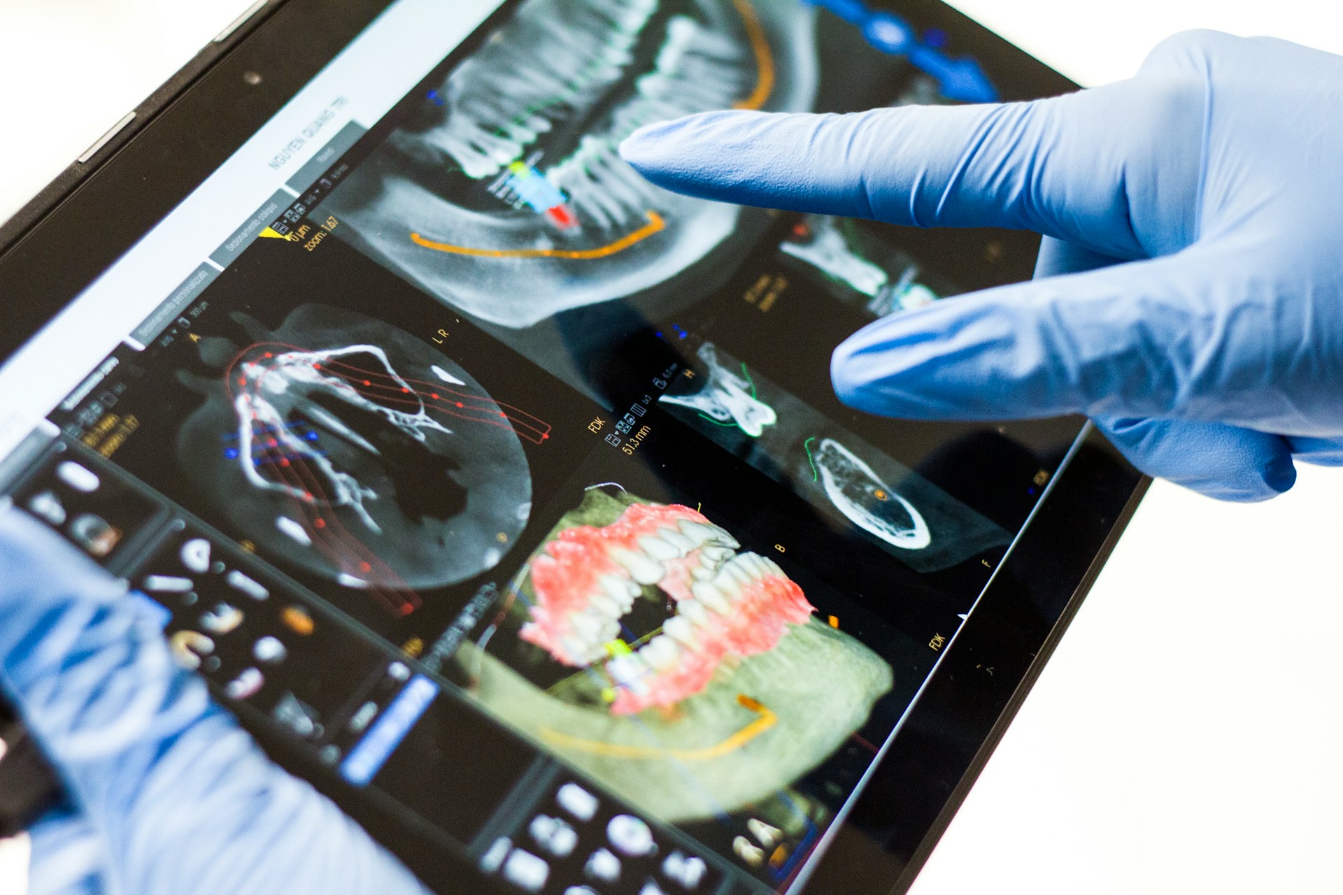 teeth scan