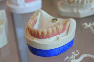 fake model teeth